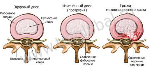 1343027123_gryja-2-3